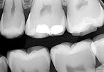 rentgendiagnostika zubov